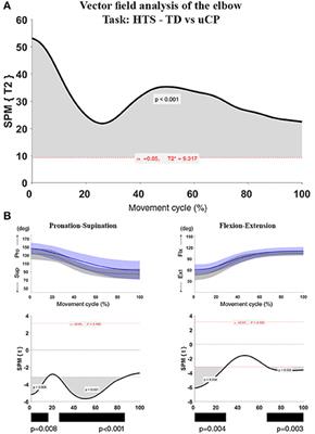 Negative Influence of Motor Impairments on Upper Limb Movement Patterns in Children with Unilateral Cerebral Palsy. A Statistical Parametric Mapping Study